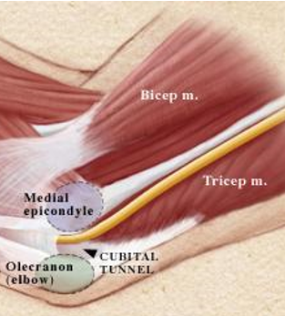 <p>Cubital Tunnel (Funny Bone) has ulnar nerve pass posterior to medial epicondyle. Taut at</p>