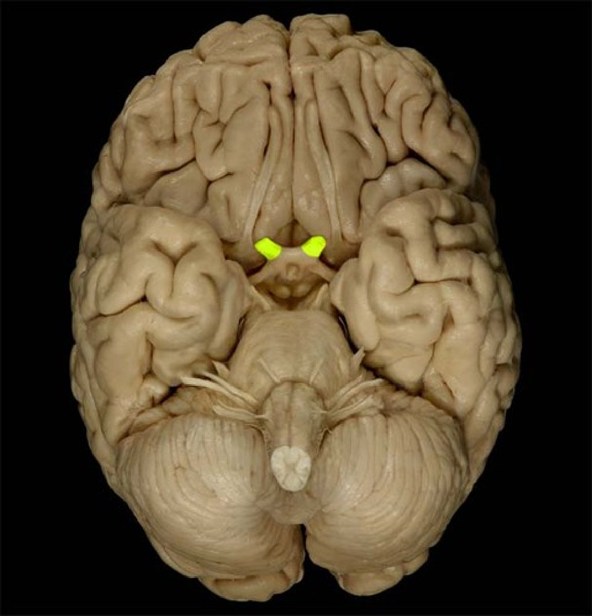<p>the nerve that carries neural impulses from the eye to the chiasma, then brain; Cranial Nerve II</p>