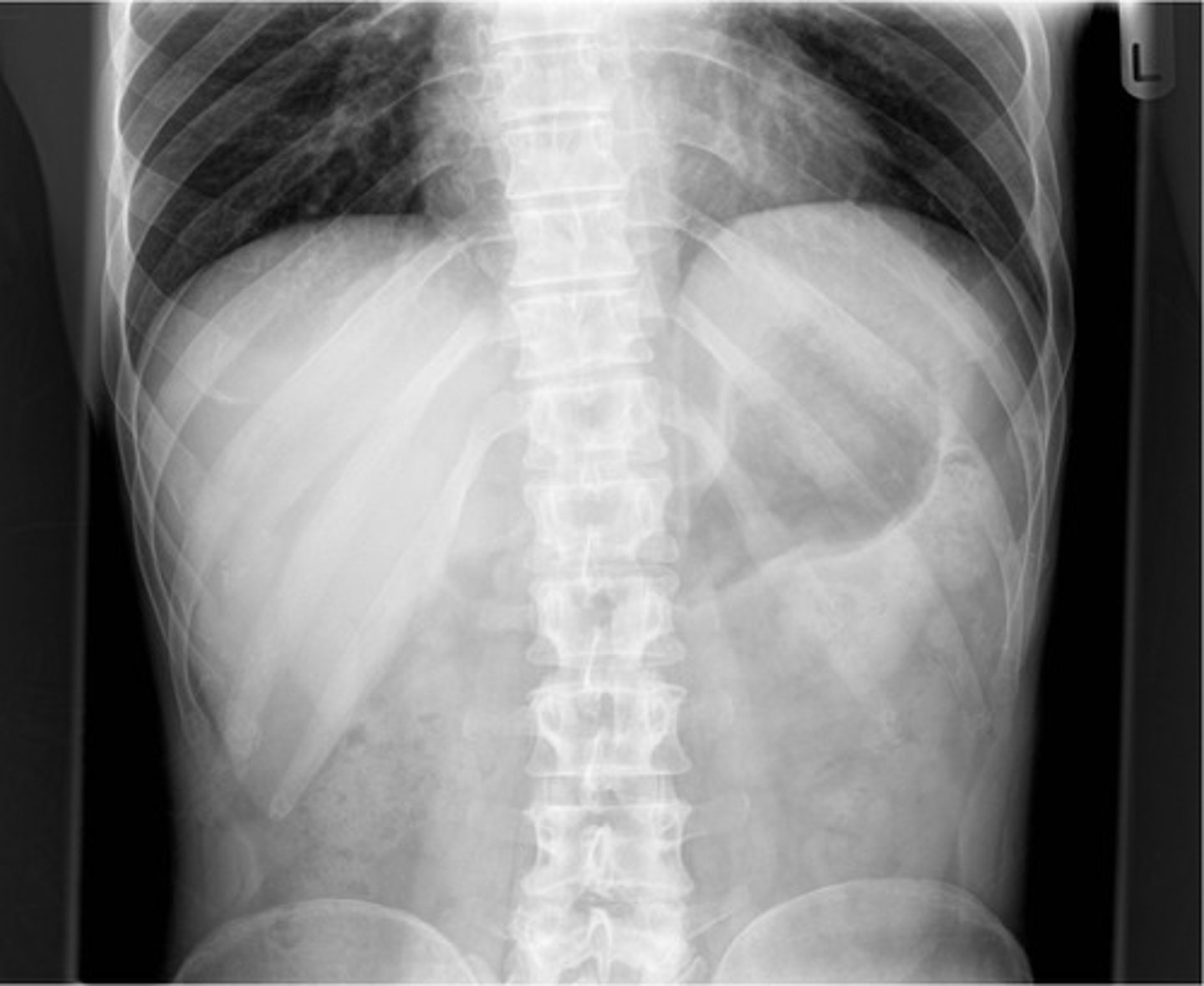 knowt flashcard image