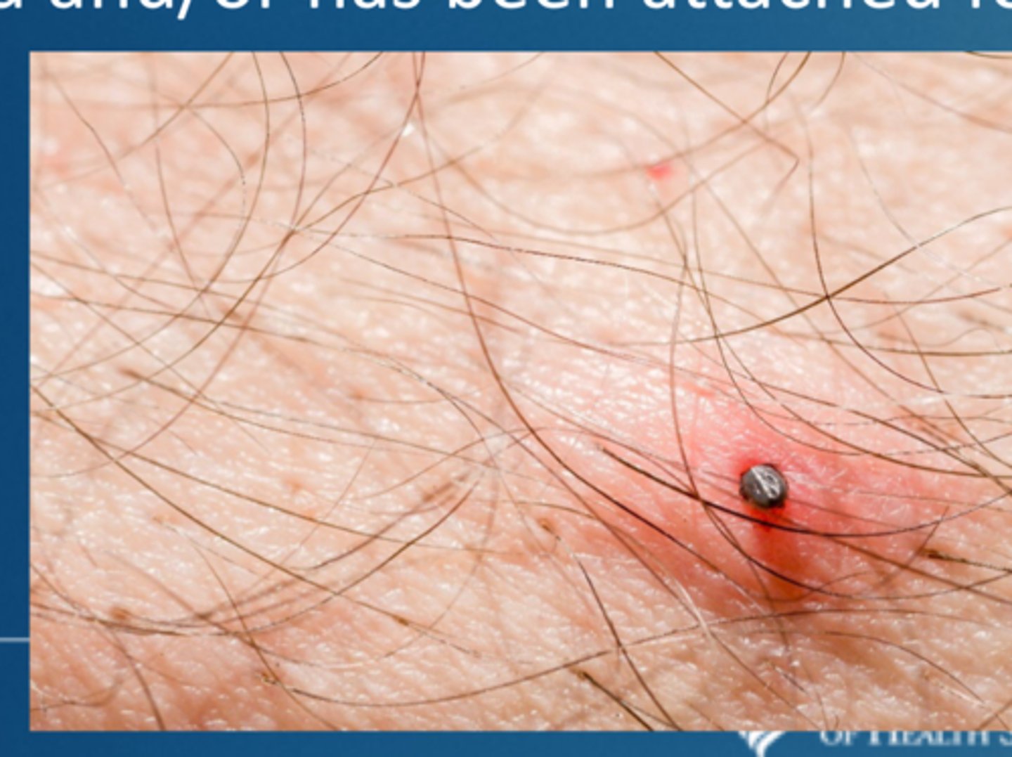 <p>ask about how long it was on them, if it was engorged, and what type of tick it was</p>