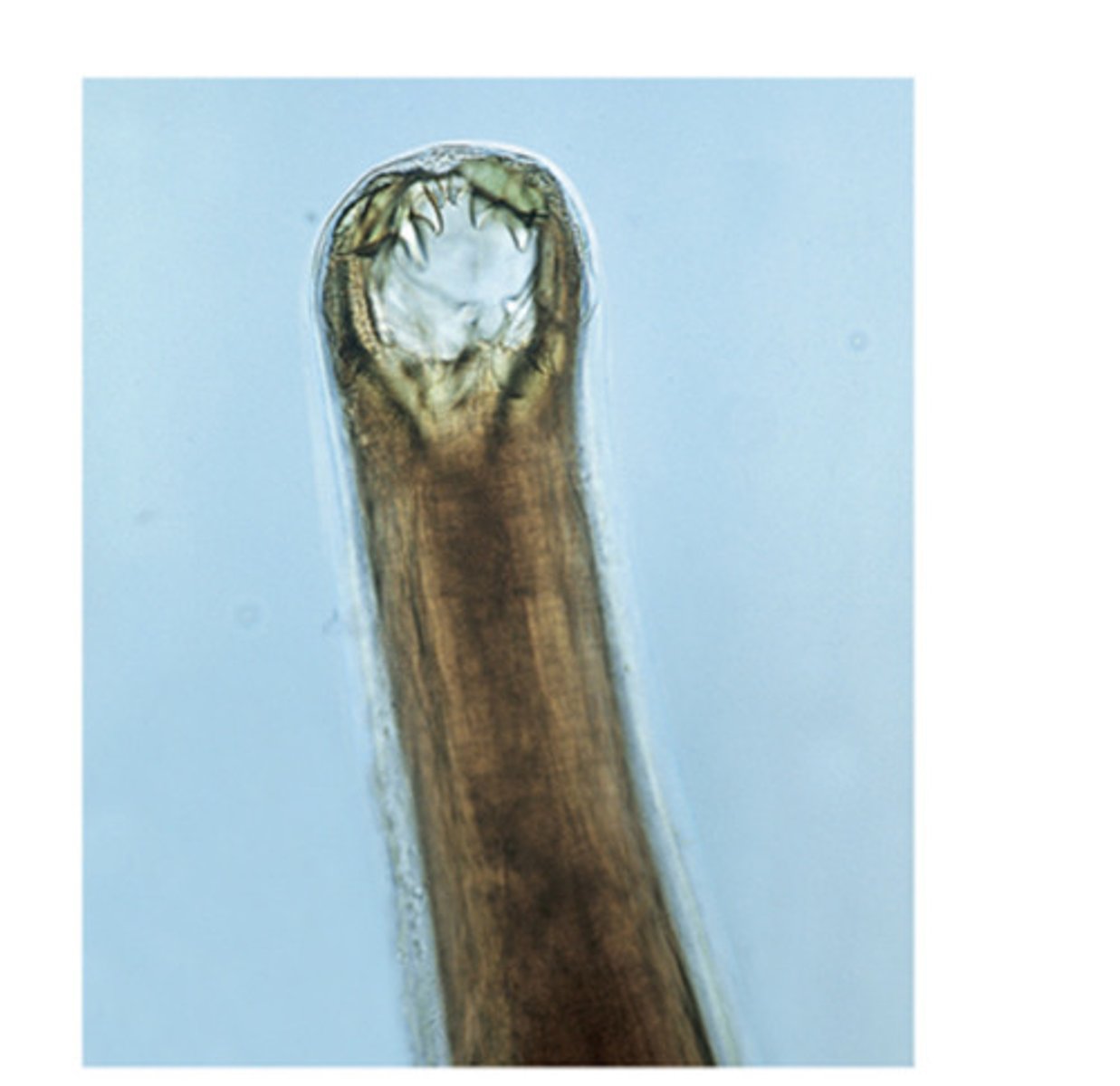 <p>This adult nematode of dogs and cats has a frightening buccal cavity that can attach to the mucosa of the small intestine. This nematode is ___, commonly named the ___</p>