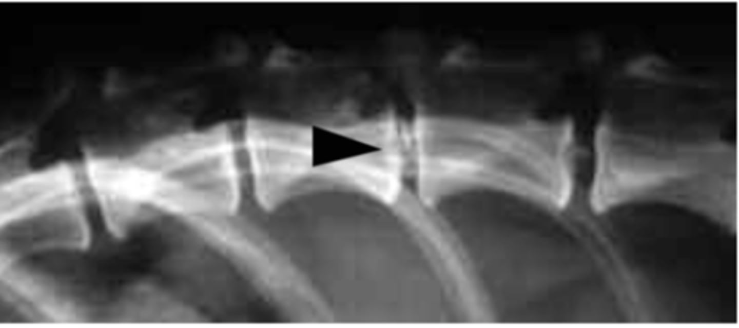 <p>What is going on with this radiograph?</p>
