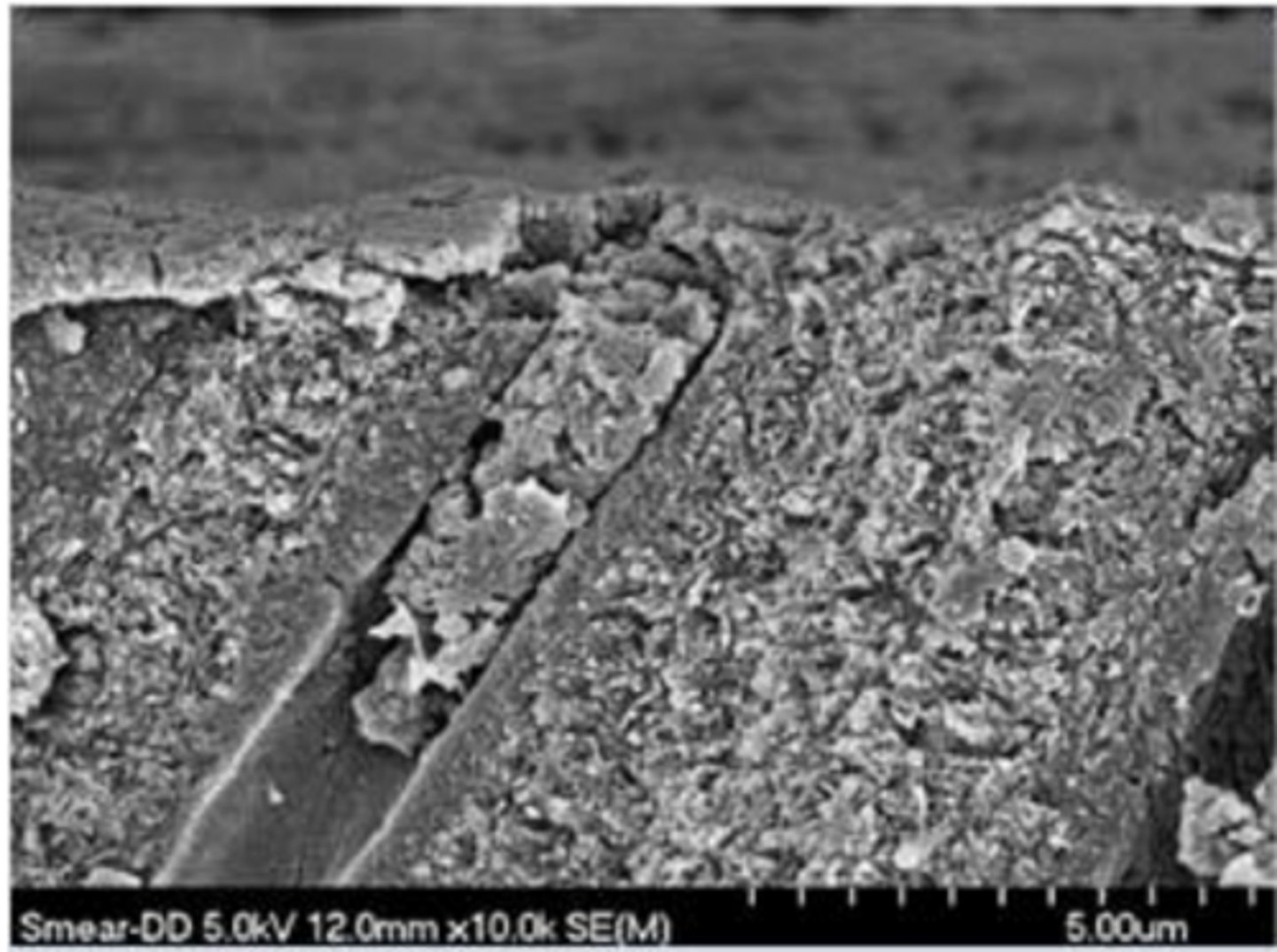 <p>1. Smear layer is removed in etch and rinse protocol --> increases dentin permeability --> acids used for etching can be irritating (etch and rinse vs self etch)</p><p>2. Toxicity of monomers: HEMA and Bis-GMA</p><p>- High cytotoxicity when applied in contact with cells</p><p>- Less cytotoxicity when dentin barrier is present (at least 05 mm)</p><p>- In vivo evidence of HEMA cytotoxicity when <0.1 mm of dentin</p><p>- HEMA diffuses through dentin (via dentinal tubules) --> may cause pulpal irritation</p>
