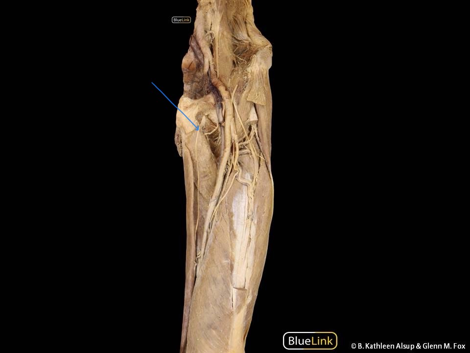 <p>The obturator nerve is a major nerve in the lower limb that originates from the lumbar plexus. It supplies sensation to the skin of the medial thigh</p><p></p><p>innervates: gracillis, pectineus, adductor magnust (adductor part)</p>