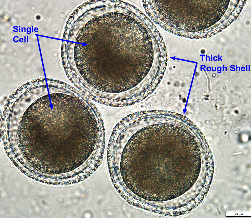 <p>What parasite egg is this?</p>