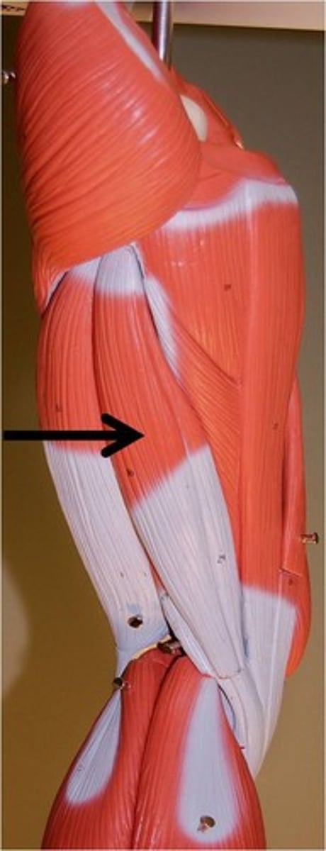 <p>A: flexion of leg; extension of thigh</p><p>O: ischial tuberosity</p><p>I: proximal shaft of tibia</p>
