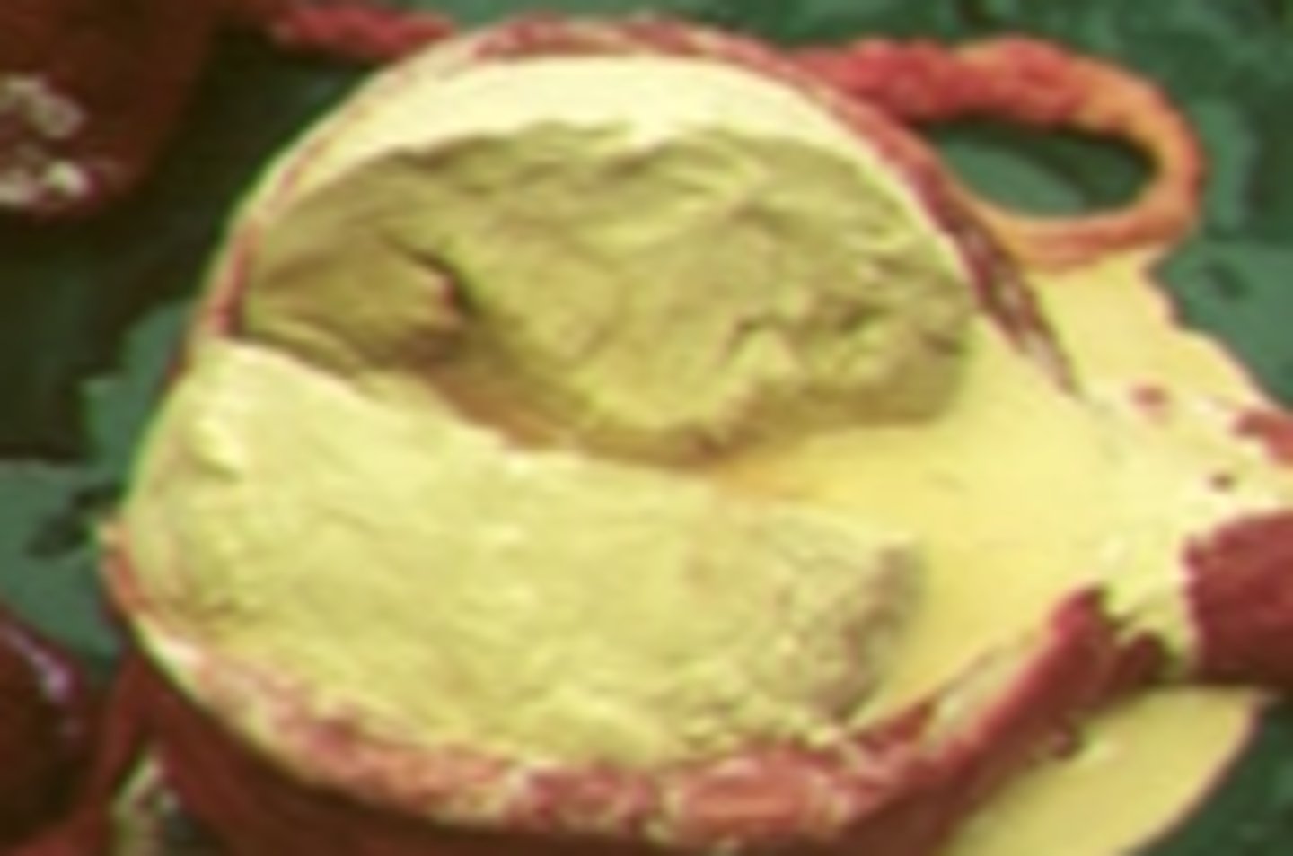 <p>-Accumulation of crystals and mucus in bladder</p><p>-Equine Protozoal Myeloencephalitis (EPM), Cauda Equina Syndrome, Equine Herpes Myeloencephalitis (neurologic EHV-1)</p>