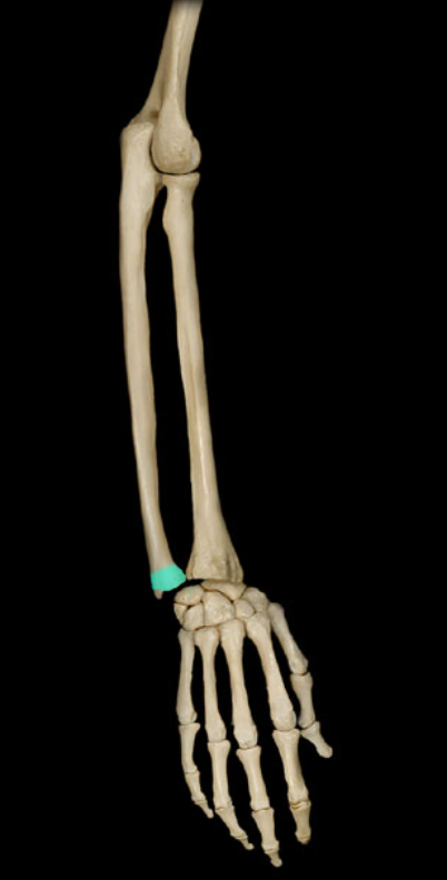 <p>Head of ulna</p>