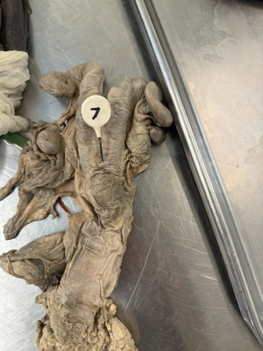 <p>A. From what classification of animal this specimen is from.</p><p>B. How can you tell?</p>