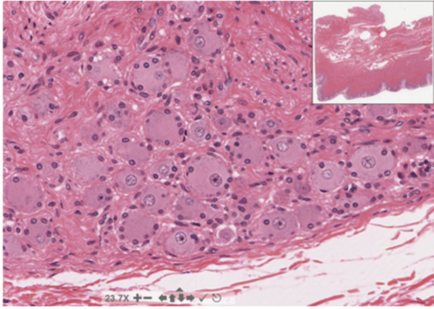 <p>Identify the organ of the PNS</p>