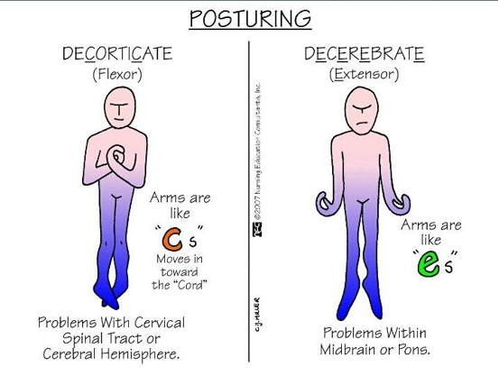 <ul><li><p>Decorticate (Flexor)</p></li><li><p>Decerebrate (Extensor)</p></li><li><p>Decorticate has a better survival rate then Decerebrate </p></li><li><p></p></li></ul><p></p>