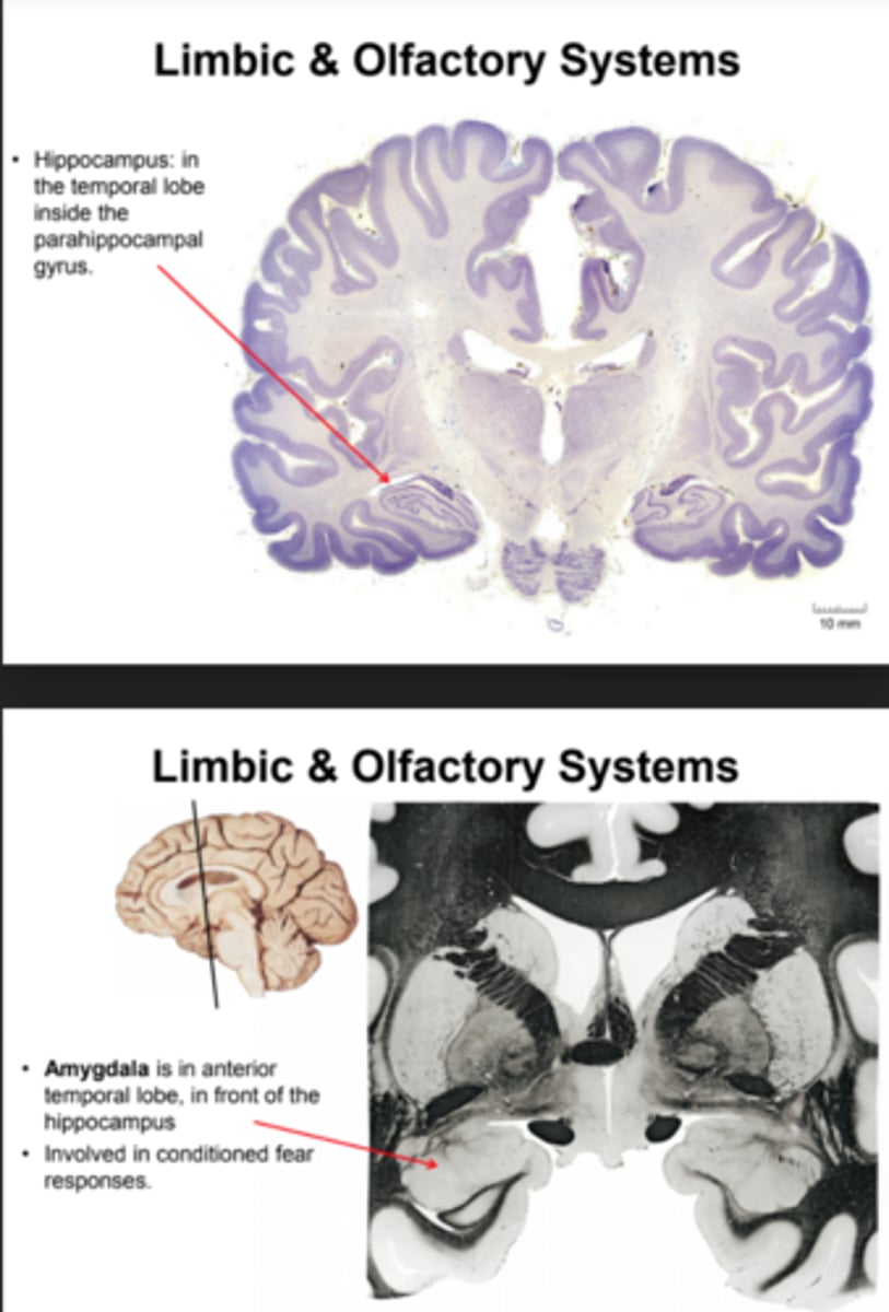 <p>- Hippocampus is in the temporal lobe inside the parahippocampal gyrus<br>- Amygdala: is in anterior temporal lobe, in front of the hippocampus (involved in conditioned fear responses)<br>- Basal Ganglia: group of nuclei in the midbrain, diencephalon, and basal region of the telencephalon (important role in the motor system and motivation (incl. drug abuse))<br> - Major Nuclei: Striatum (telencephalon), Globus pallidus (telencephalon), subthalamic nucleus (diencephalon), Substantial nigra (midbrain)</p>