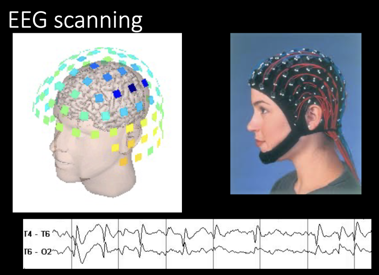 <ul><li><p>electroencephalogram (EEG)</p></li><li><p>Magnetoencephalograph (MEG)</p><ul><li><p>they record electrical and magnetic activity in the brain </p></li><li><p>they DO NOT visual brain activity </p></li></ul></li></ul><p></p>