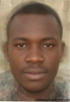 <p>Identify this Phenotype</p>