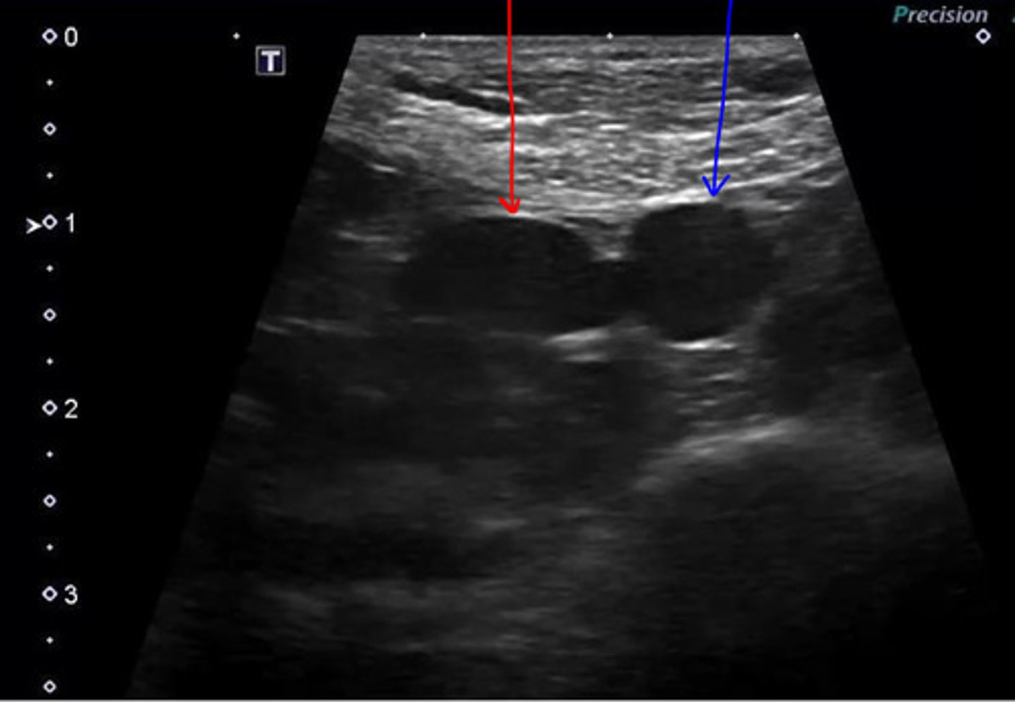 <p>ID red and blue, which one is on the right side of the body and which is on the left? what orientation is this?</p>