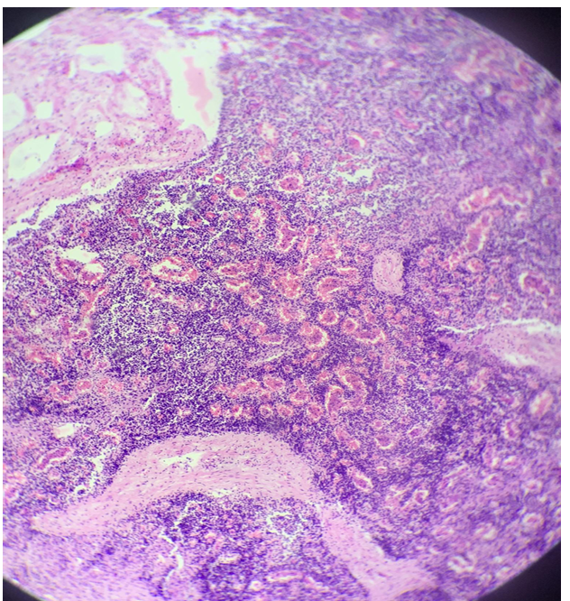 <p>this is?</p><img src="https://knowt-user-attachments.s3.amazonaws.com/cfcf0128-ac59-4056-b624-578af57ab617.png" data-width="50%" data-align="center"><p></p>