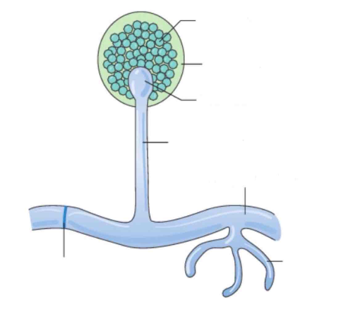 <p>Name the spore and its structures:</p>