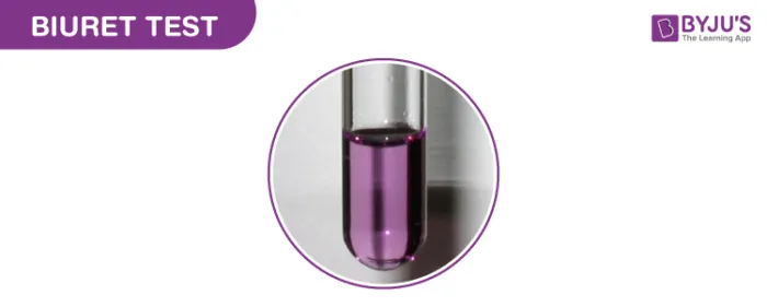 <p>Is this a positive or negative Biuret test result.</p>