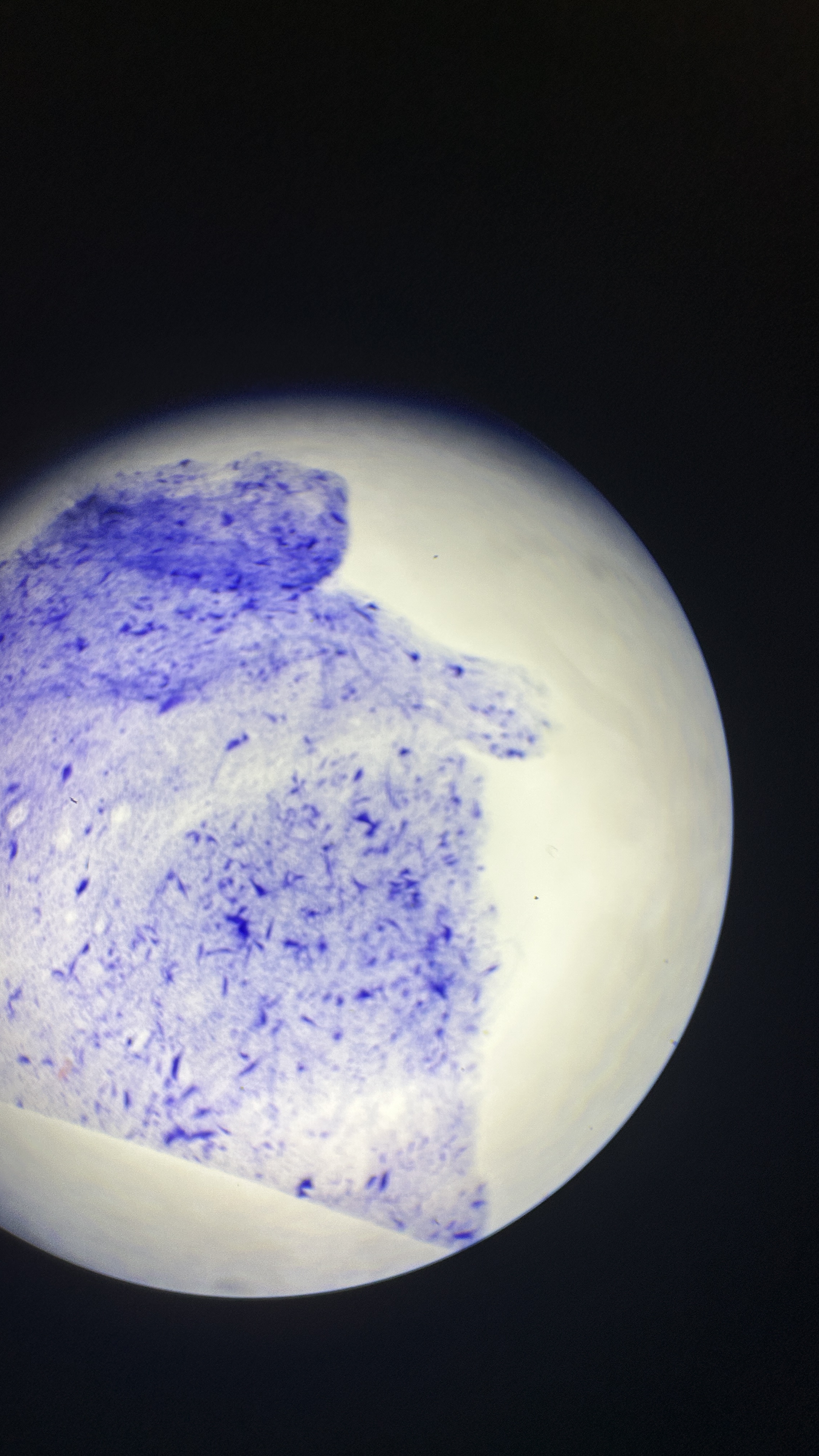 <p>What is the magnification level of the Nervous Tissue?</p>