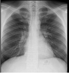 <p>What is this and what type of scan </p>