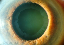 <p>identify </p>