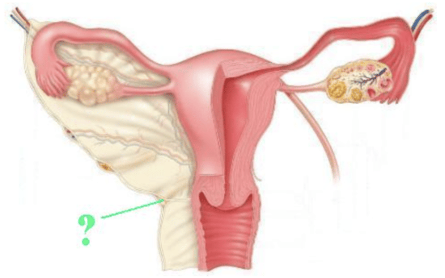 <p>uterosacral ligament</p>