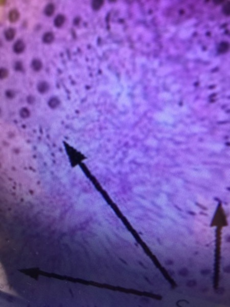 <p>The mature motile make sex cells that typically have a compact head and one or more long flagella for swimming.</p>