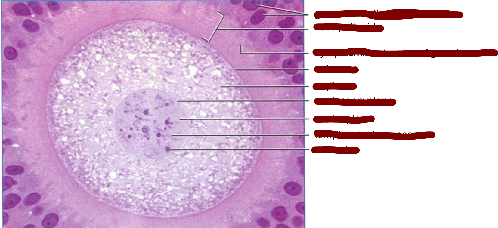 <p>Section through a cat graafian follicle </p>