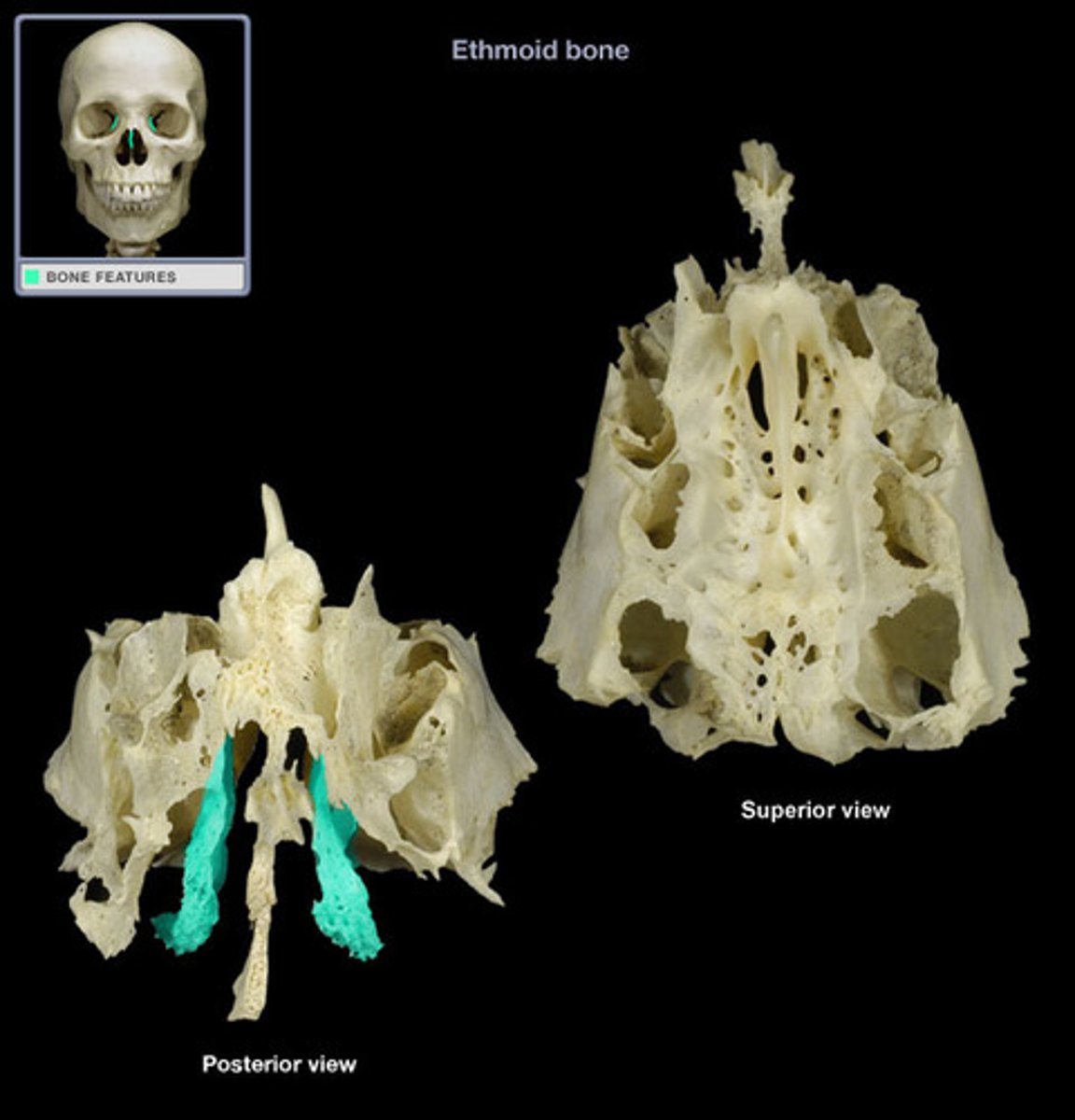 <p>What kind of Nasal Conchae</p>