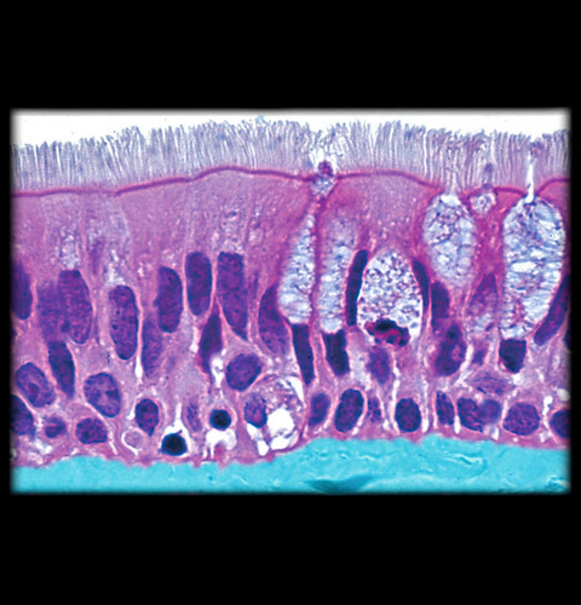 <p>Pseudostratified ciliated epithelium.</p>