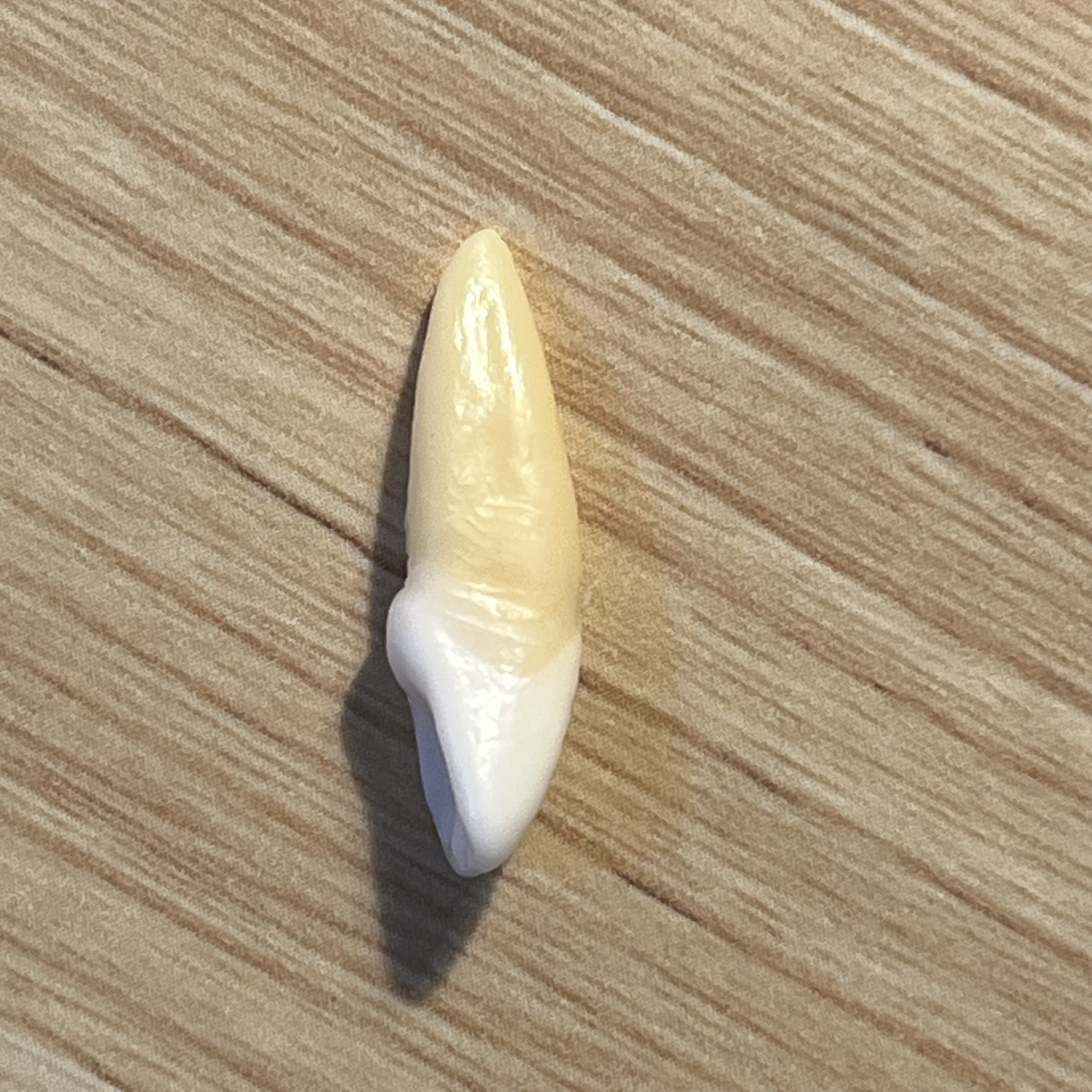 <p>What tooth is this (with view)?</p>