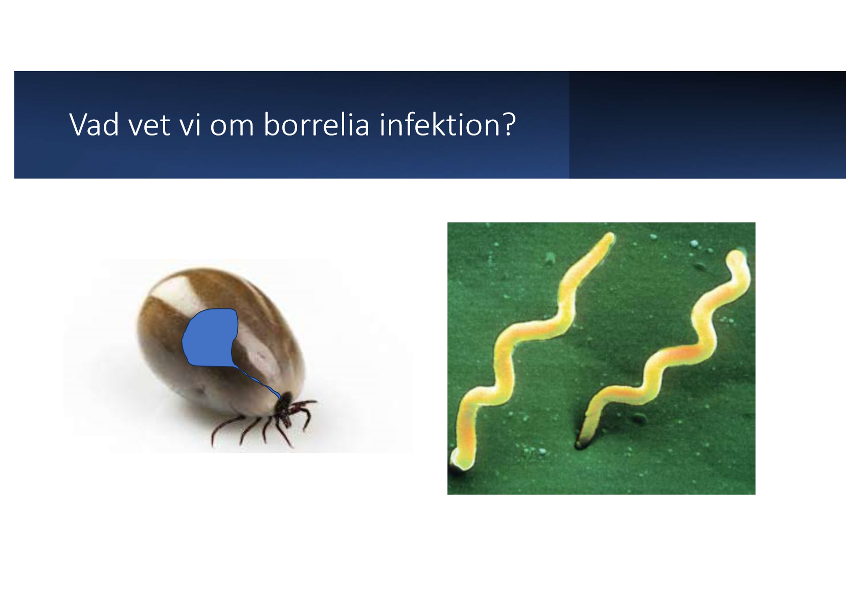 <ul><li><p>Spiroket (bakterie): har spiralrörelser när de kommer in i huden. Om man har en liten rodnad dag 1 blir rodnaden därför större, rodnaden förvrider som en ökad cirkel. Den centrala delen hinner dock läka efter ett tag → ser en ring. </p></li><li><p>Måste behandlas med antibiotika</p></li><li><p>Smittar via fästingbett (vektorburen zoonos)</p></li><li><p>Miljön för fästingen är viktig: en klassisk patient kommer i början av mars ca, högre upp i Sverige träffar man första patienten längre fram på året. Patienten kanske bor på landet osv. </p></li></ul><p></p>
