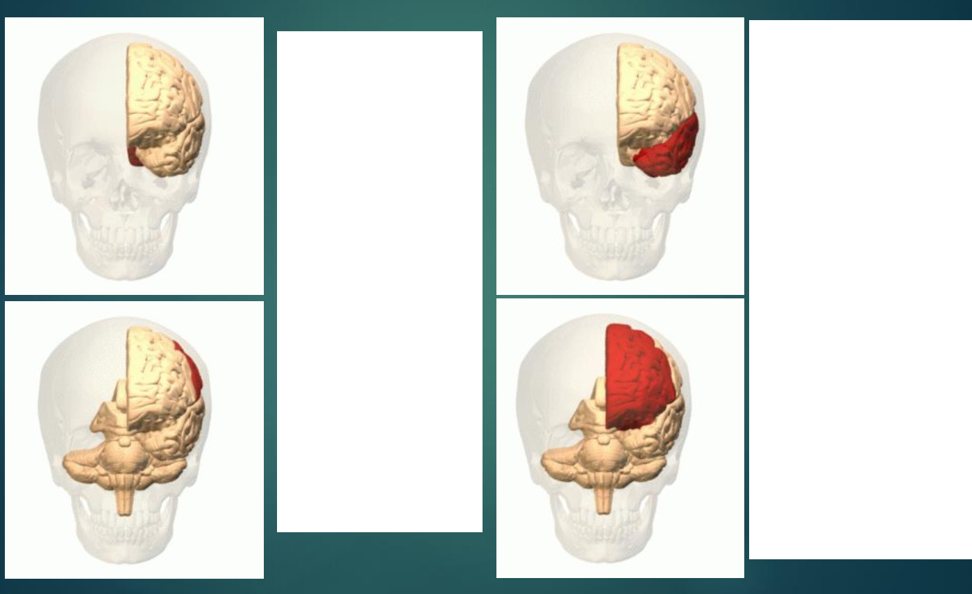 <p>Parts of the cerebral cortex (do not need to describe their roles, but only describe where they are located in the brain)</p><ul><li><p>four lobes</p></li></ul><p></p>