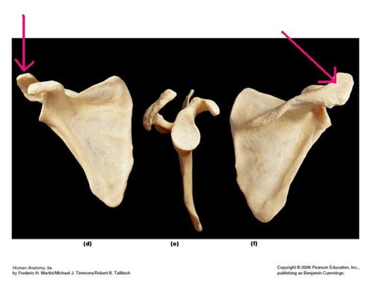 <p>acromion of scapula</p>