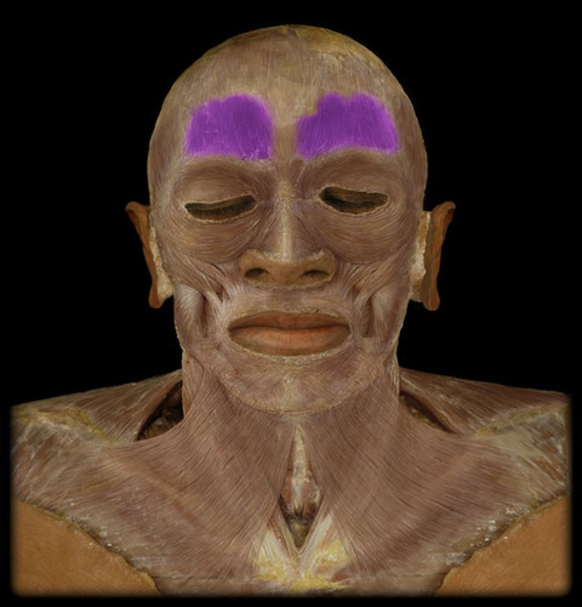 <p>elevates eyebrows, creases skin of forehead, move scalp forward</p>