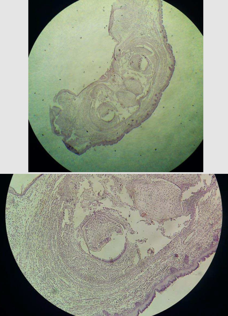 <p>Rozwój zęba - <span>tooth development</span></p>