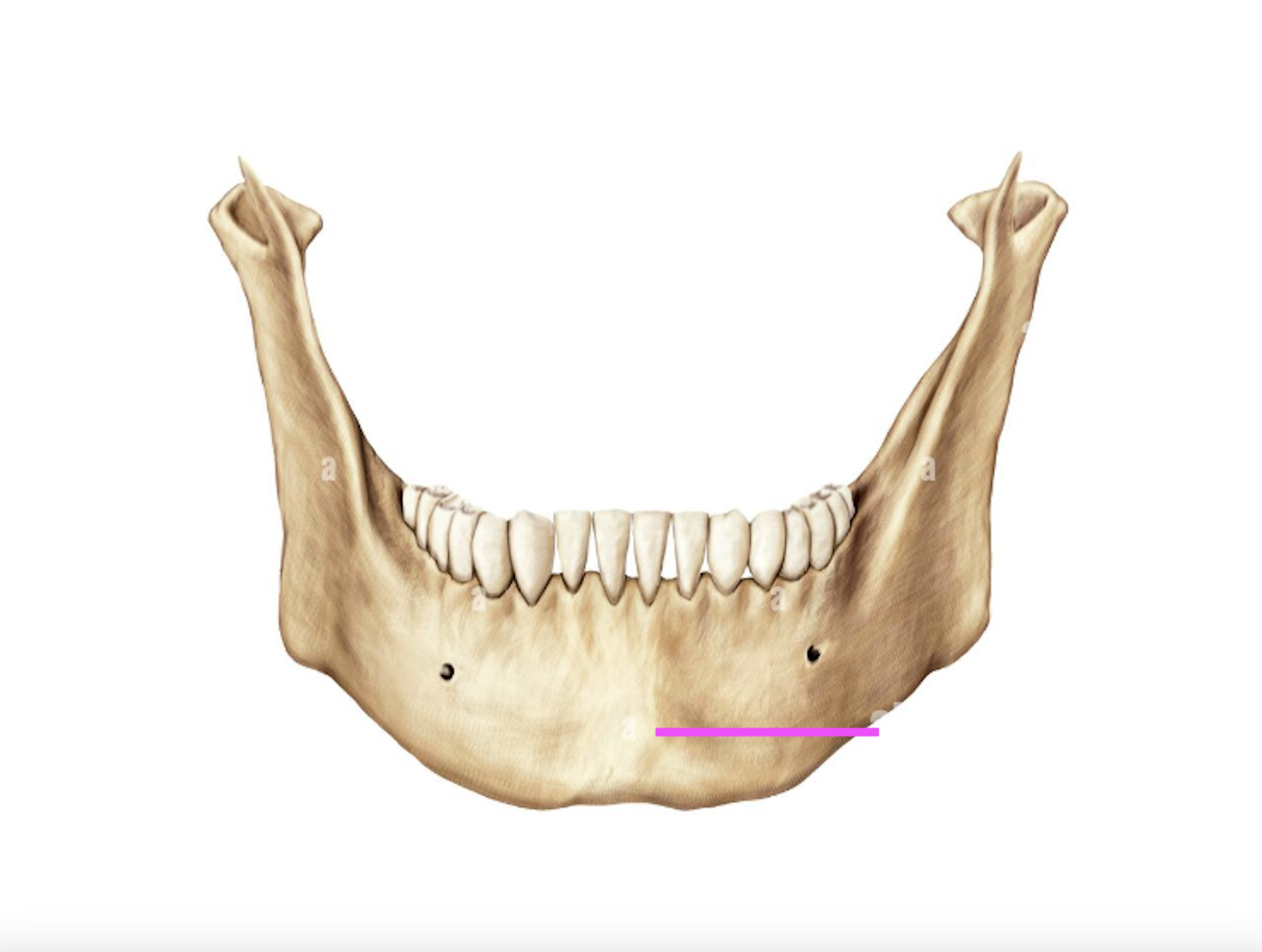 <p>What bone marking is this?</p>