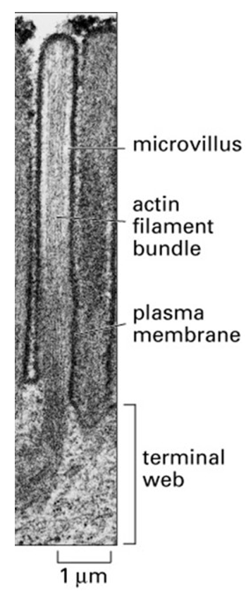 \
The image above shows a microvillus in an intestinal epithelial cell. What protein is cross-linking the actin filaments in the microvillus?