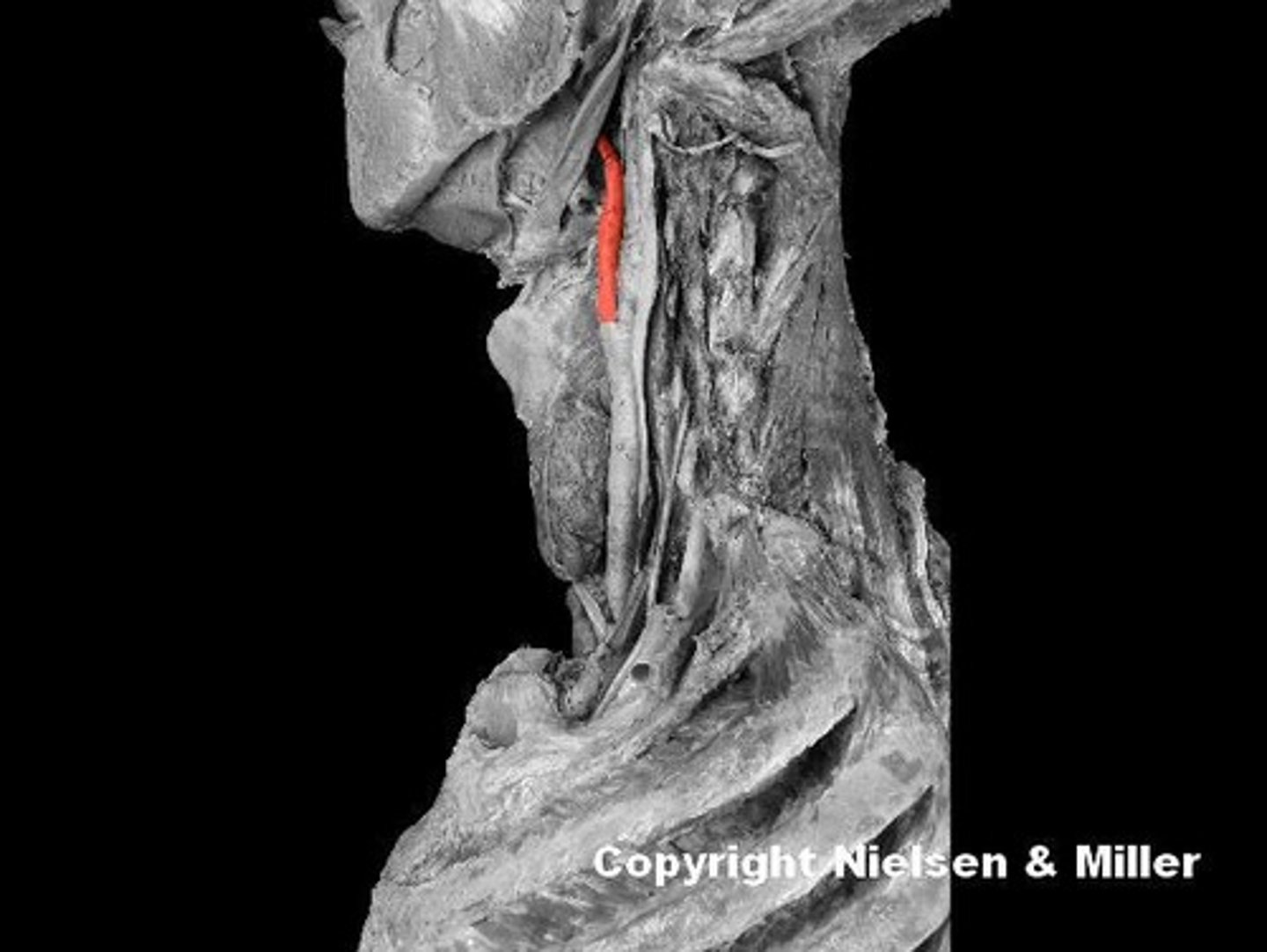 <p>Identify the highlighted branch of the left common carotid artery.</p>