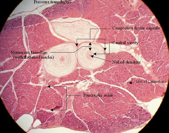 <p>The depicted microscopic slide shows a _______</p>