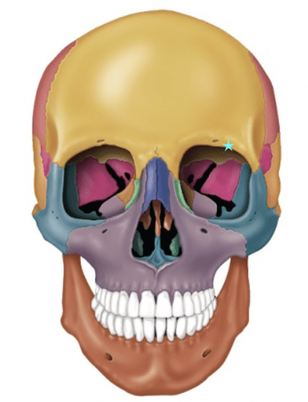 term image