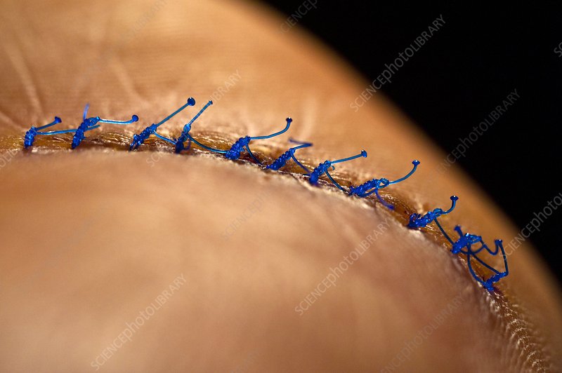 <p>to suture</p>