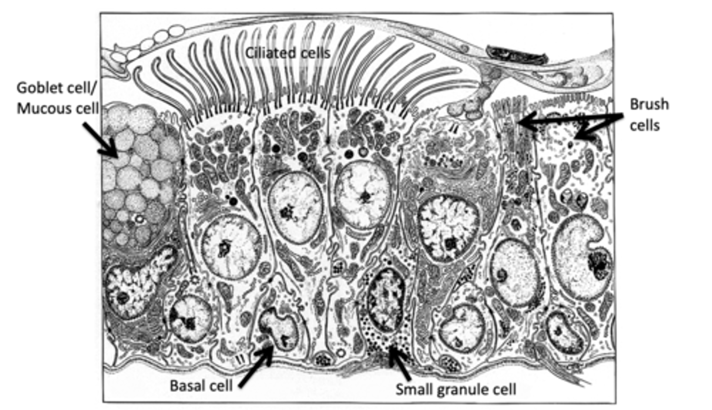 <p>1) Brush cells (sensory receptors)</p><p>2) Dense core granule cells</p><p>3) Clara cells </p>