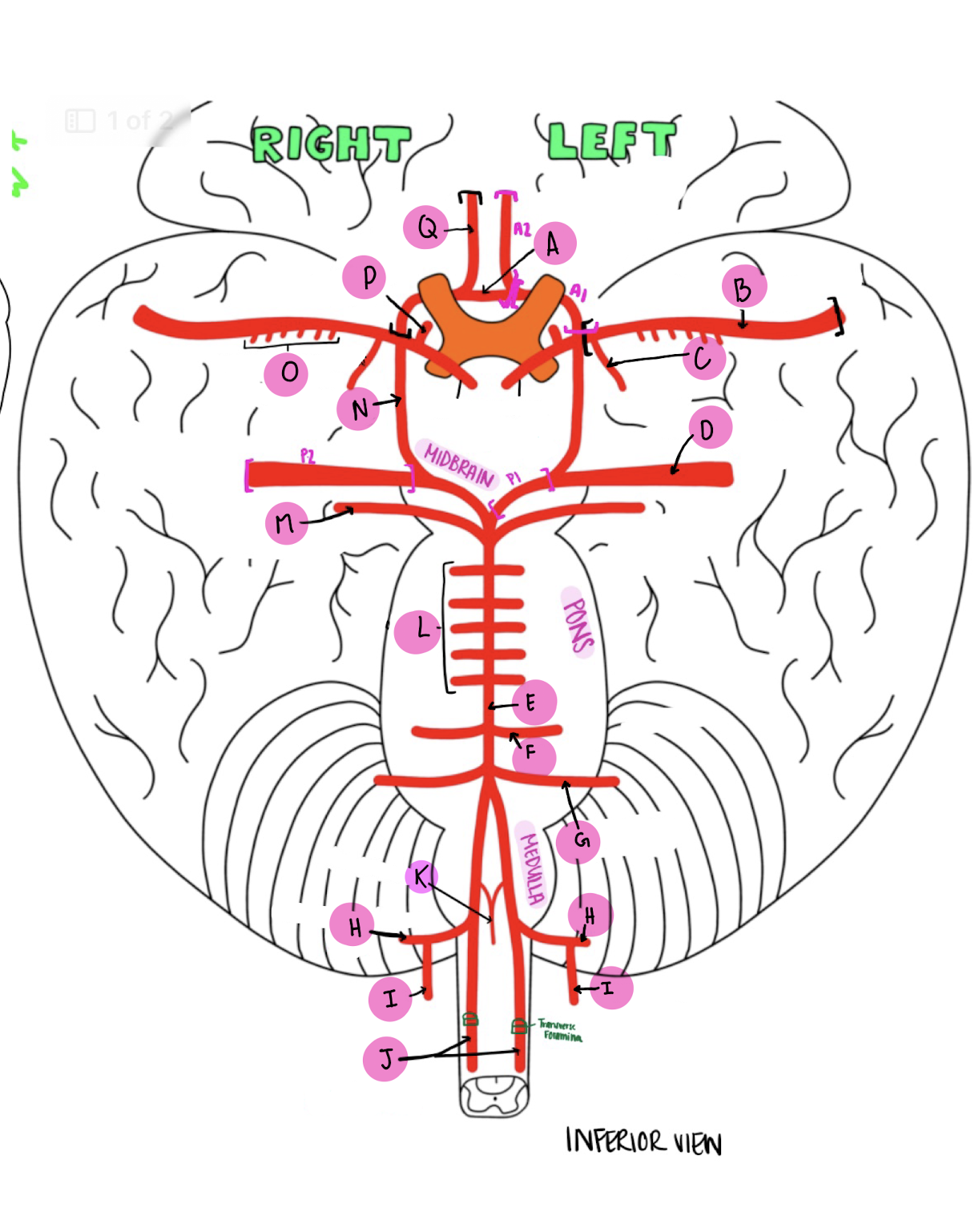 <p>What artery is labeled M?</p>