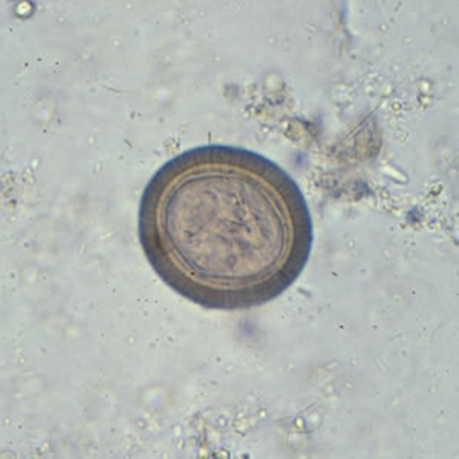 <p><span>You see the following in a stool sample from a patient that has recently eaten undercooked pork and is experiencing abdominal pain.&nbsp; Which of the following is the most likely causative agent of your patient’s illness?</span></p>