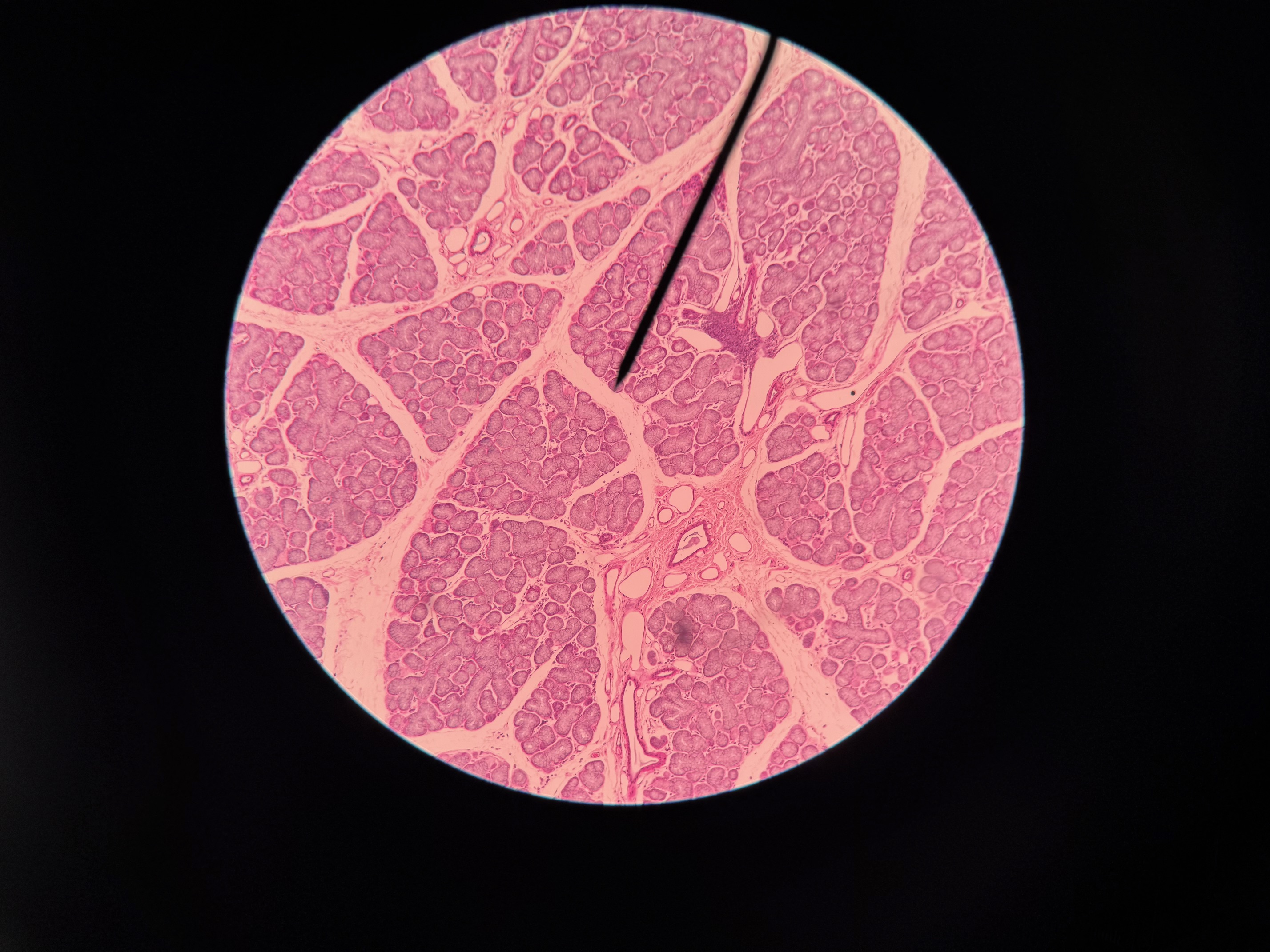 <p>Organ?</p>