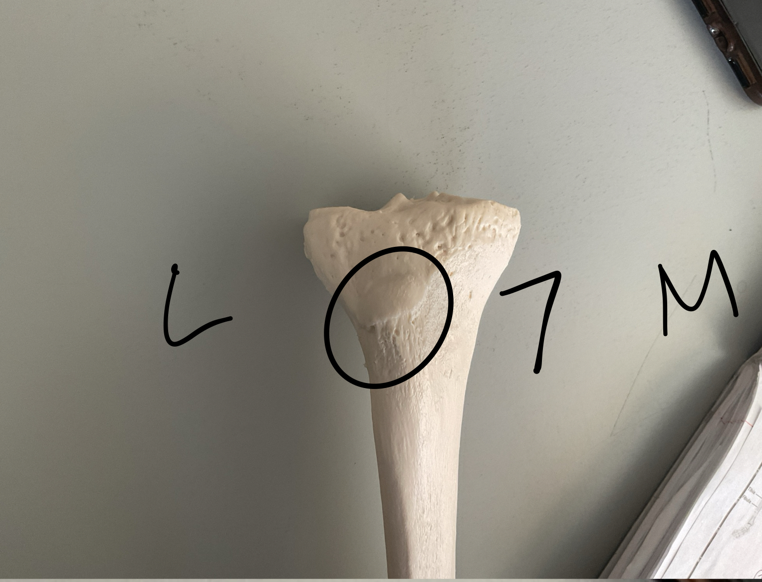 <p>7 tibia </p>