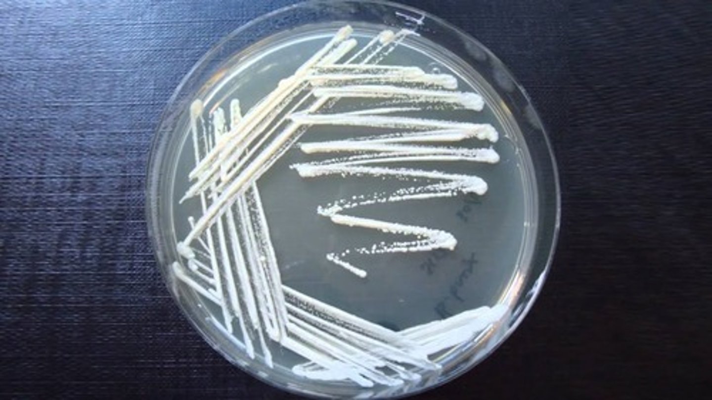 <p>Pour plate: Colonies grow within/on top of agar; Streak plate: Colonies grow only on the surface.</p>