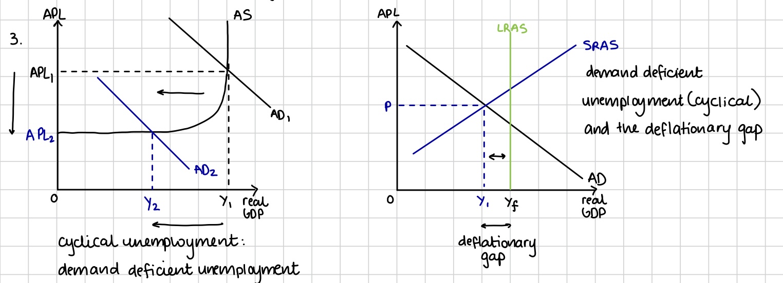 <p>Unemployment caused by a lack of demand for goods and services in the economy, downturn in the business cycle. Shown using a AD-AS diagram that shows a deflationary gap </p>