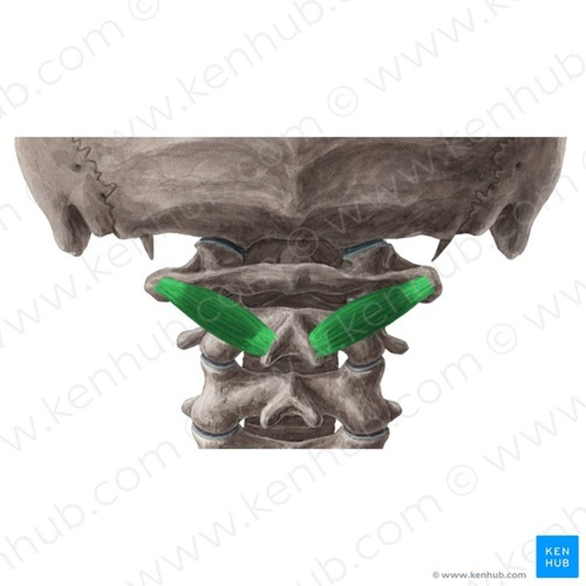 <p>Welke spier is dit?</p>